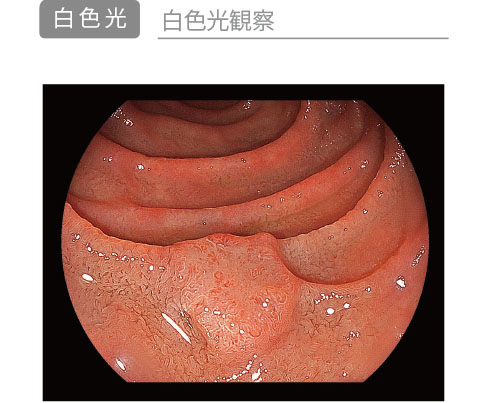 白色光観察