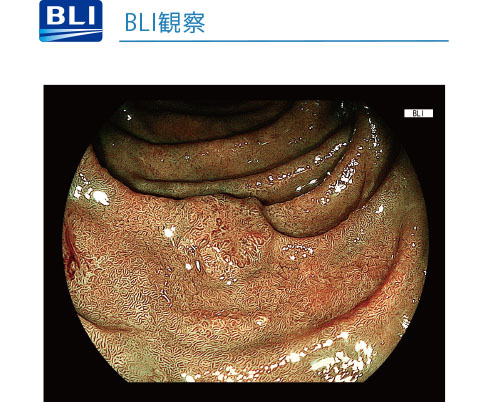 BLI観察
